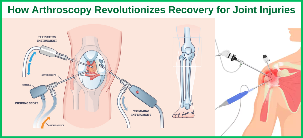 How Arthroscopy Revolutionizes Recovery for Joint Injuries