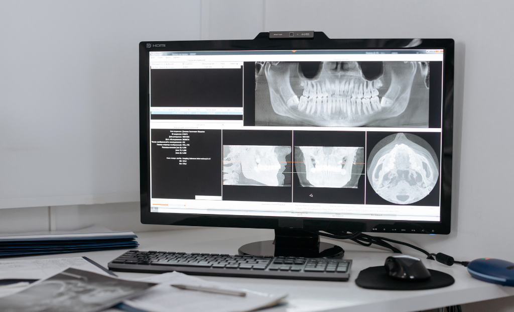 What Is Dental Imaging?